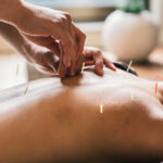 camberwell acupuncture and chinese medicine